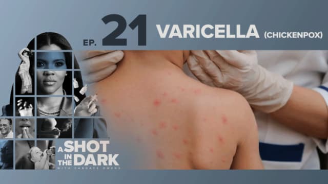 A Shot In The Dark Ep 21 | Varicella (Chickenpox)